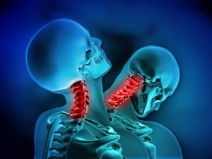 Facts you need to know about whiplash